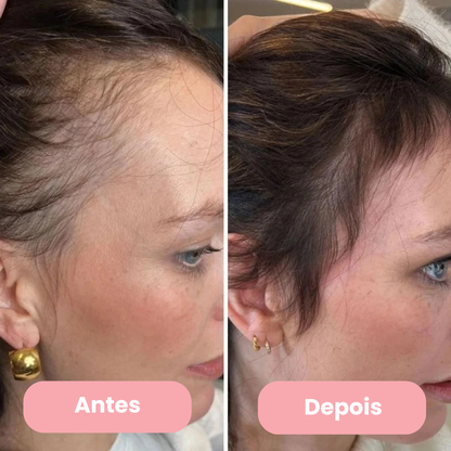 AlluHair - 4 tratamentos para queda de cabelo e fios fracos