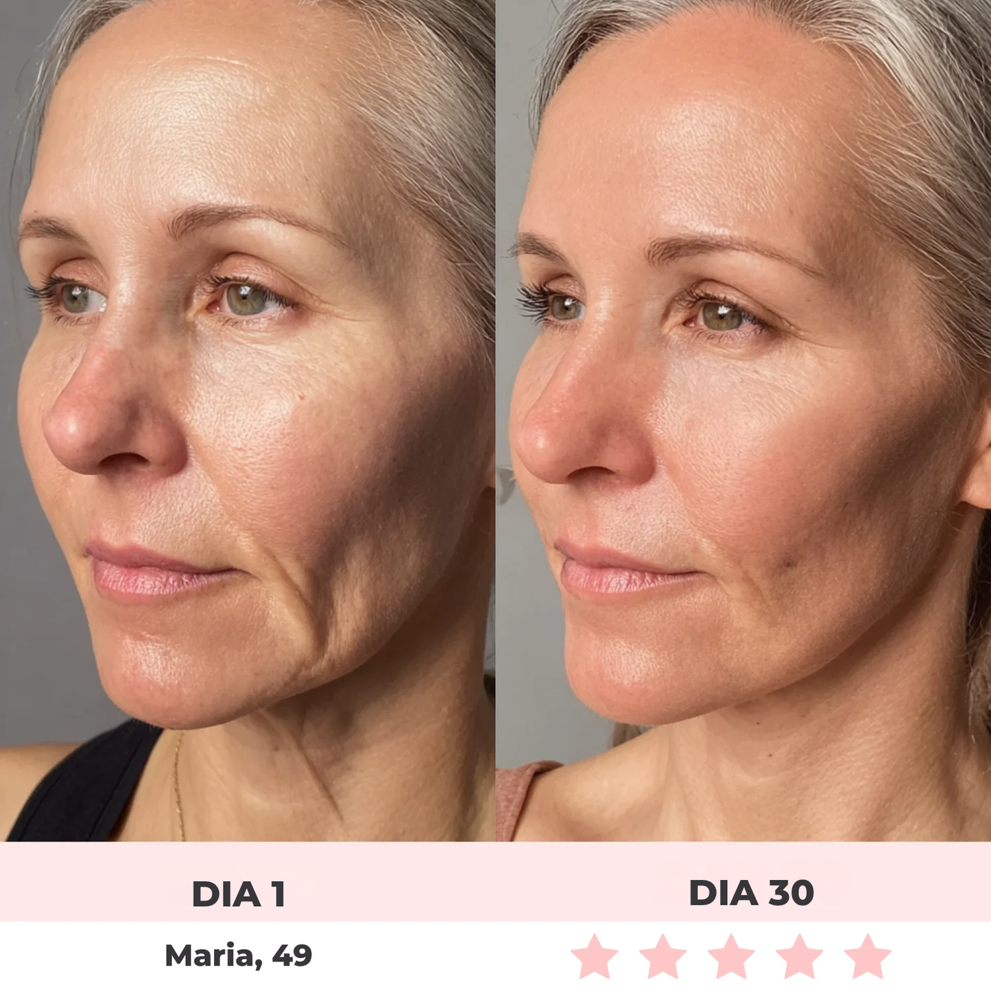 Alluface 7 em 1 - Tratamento facial completo [rugas-flacidez-papada]