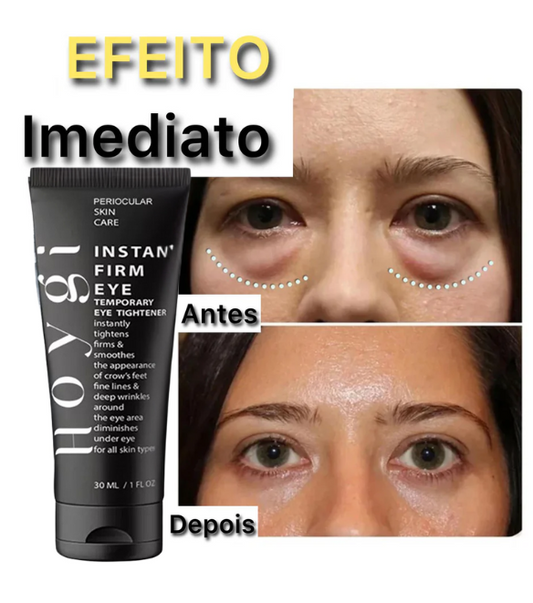 Eye cream - Tratamento para área dos olhos [efeito imediato]