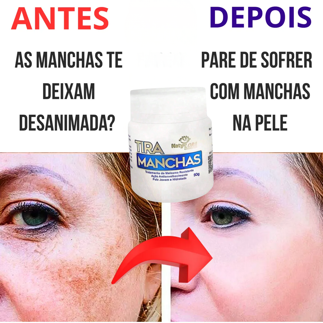 Allucream - Creme clareador de manchas [melasma & escurecimento da pele]  COMPRE 1 LEVE 2