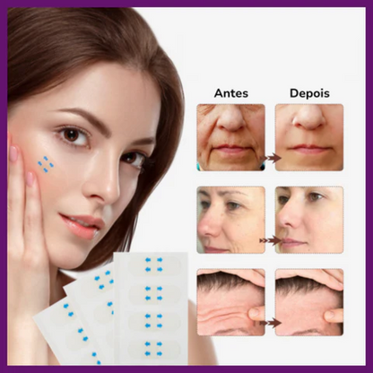 Allutape - Adesivo efeito lifting facial em segundos